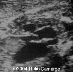 case0130-10