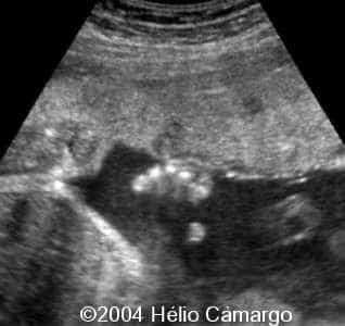 case0130-11