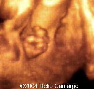 case0130-13