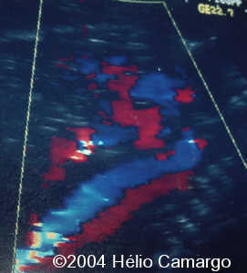 case0130-15