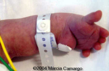 case0130-16