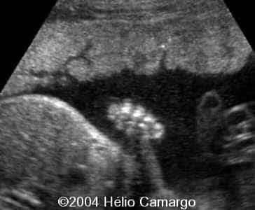 case0130-2