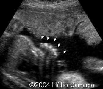 case0130-22