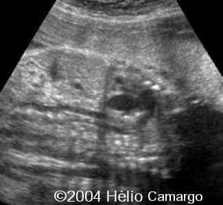 case0130-25