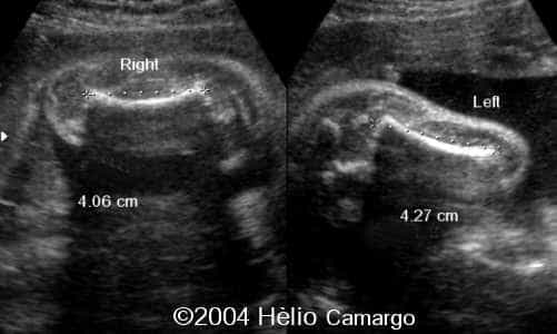 case0130-27