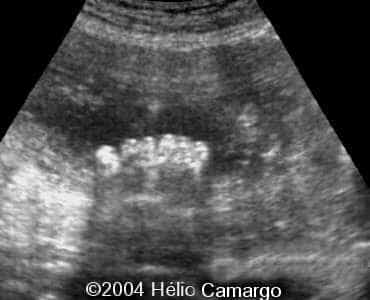 case0130-5