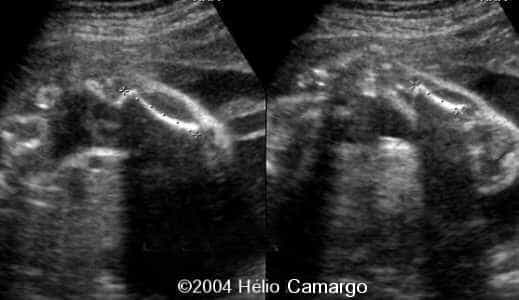 case0130-6