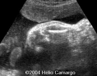 case0130-7