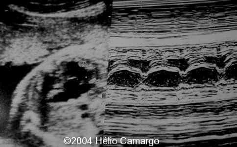 case0130-9