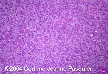 case0131_11