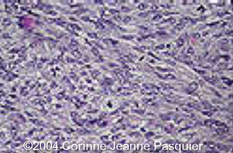 case0131_12