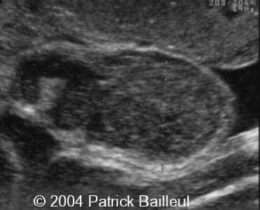 case0131_3