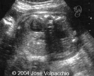 case0132-01