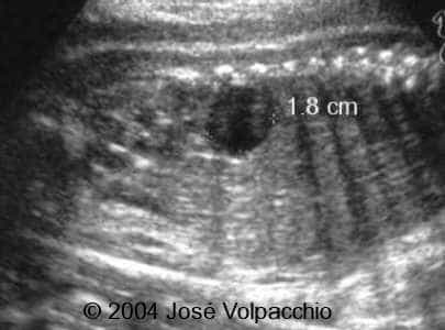 case0132-02