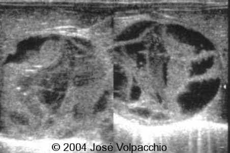 case0132-03