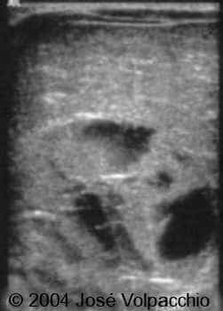 case0132-04