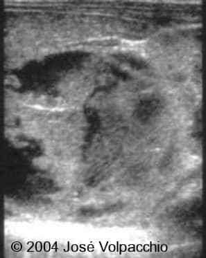 case0132-05