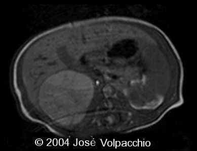 case0132-06