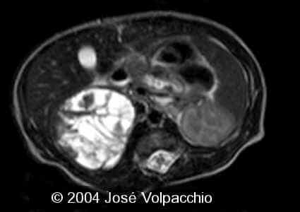 case0132-07