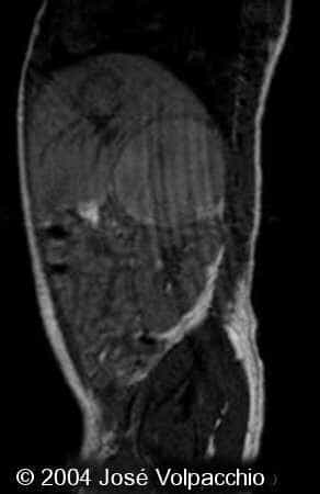 case0132-08