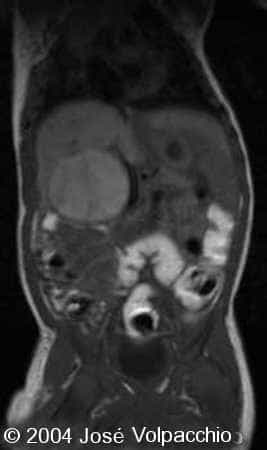 case0132-09