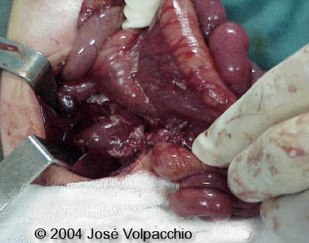 case0132-13
