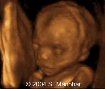 case0135_01
