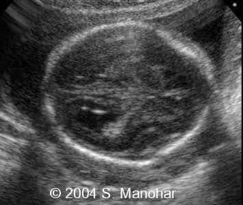case0135_03