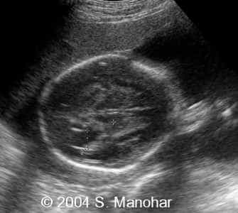 case0135_04