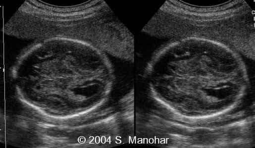 case0135_06