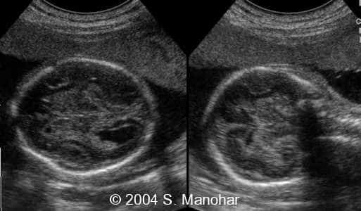 case0135_07
