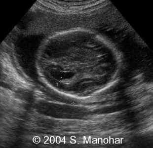case0135_11