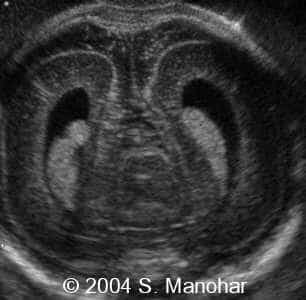 case0135_12