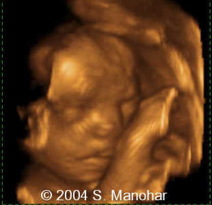 case0135_18