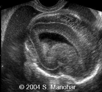 case0135_20