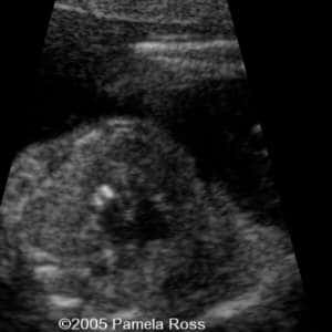 case0149_1