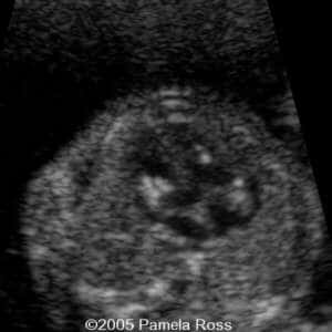 case0149_3