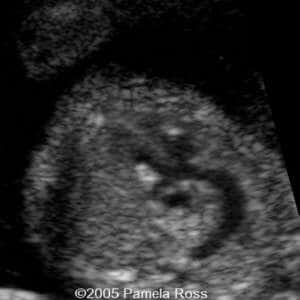 case0149_5