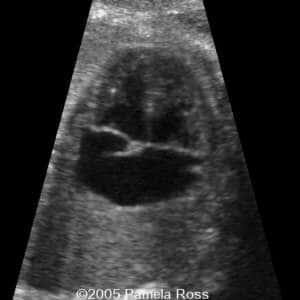 case0149_6