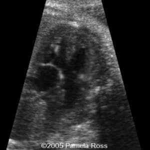 case0149_7
