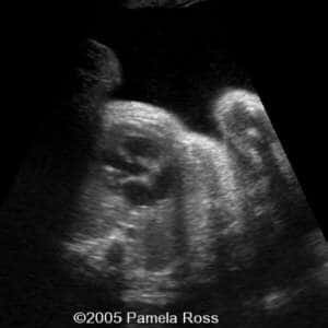 case0149_8