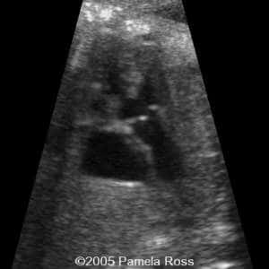 case0149_9