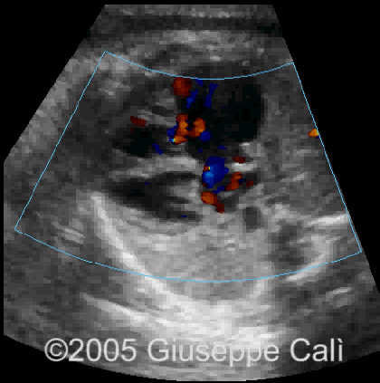 case0158_1