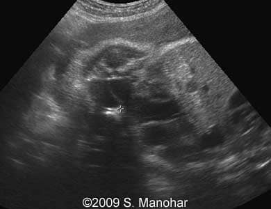 Case1-04
