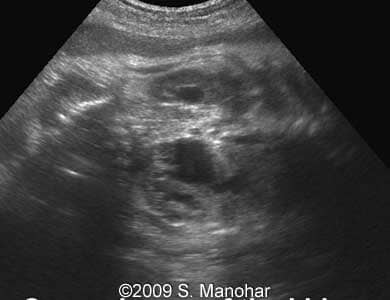 Case1-05