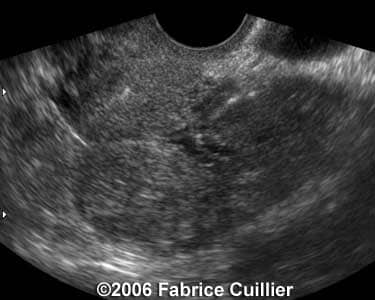 case10a