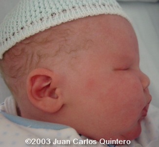 case1105-01