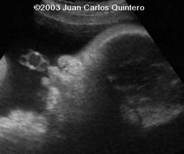 case1105-03