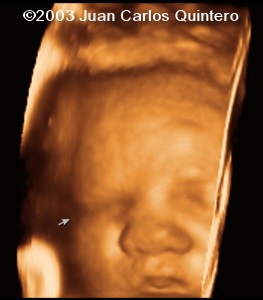 case1105-04