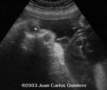 case1105-07